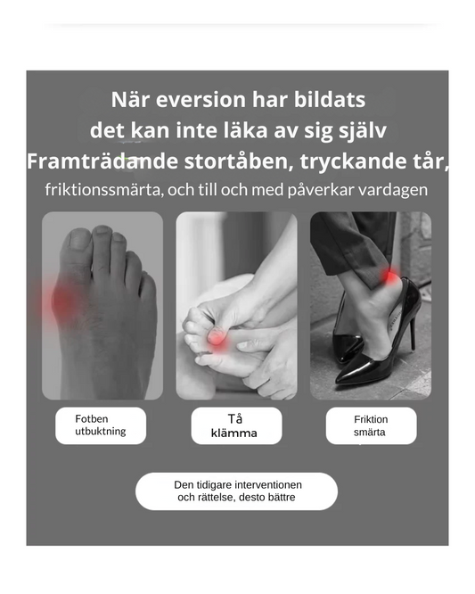 Hallux Valgus-korrigerande ärmar – Gel-tåseparerare för hallux valgus och fotvärkslindring